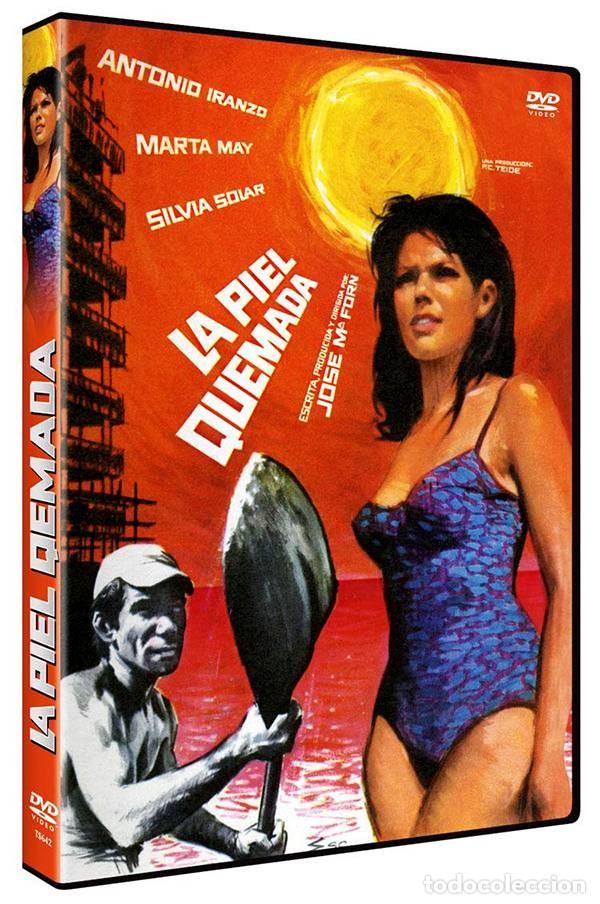 Series de TV: La piel quemada